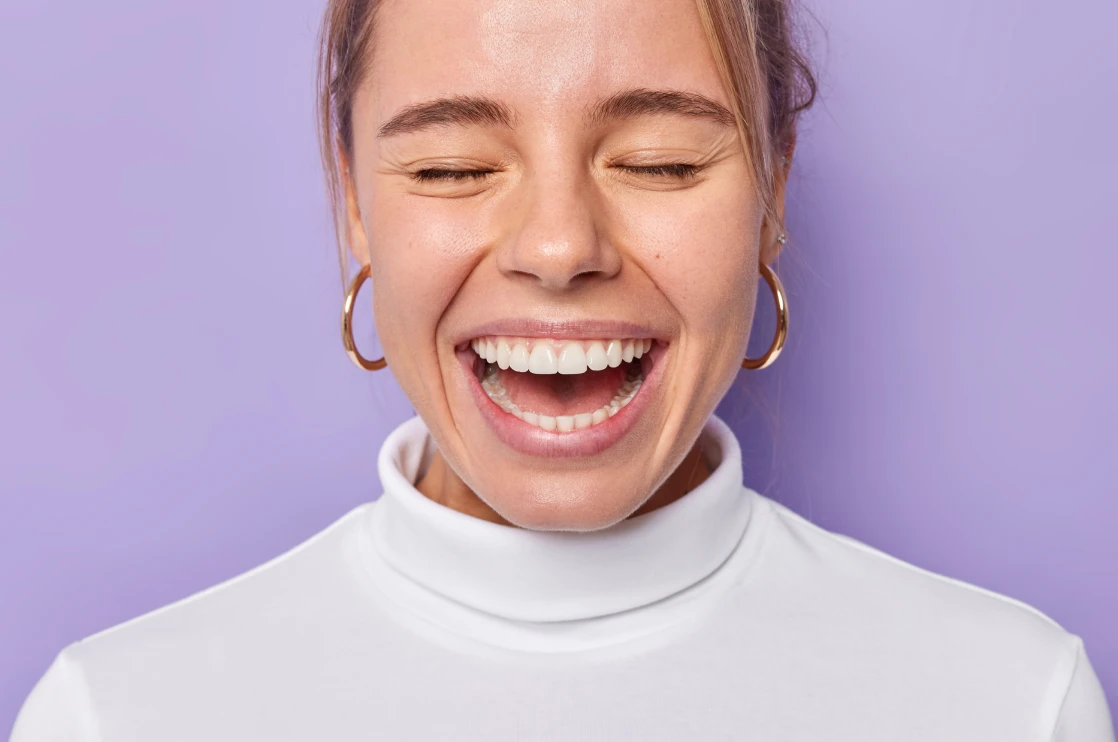 Tratamientos Dentales-Carillas